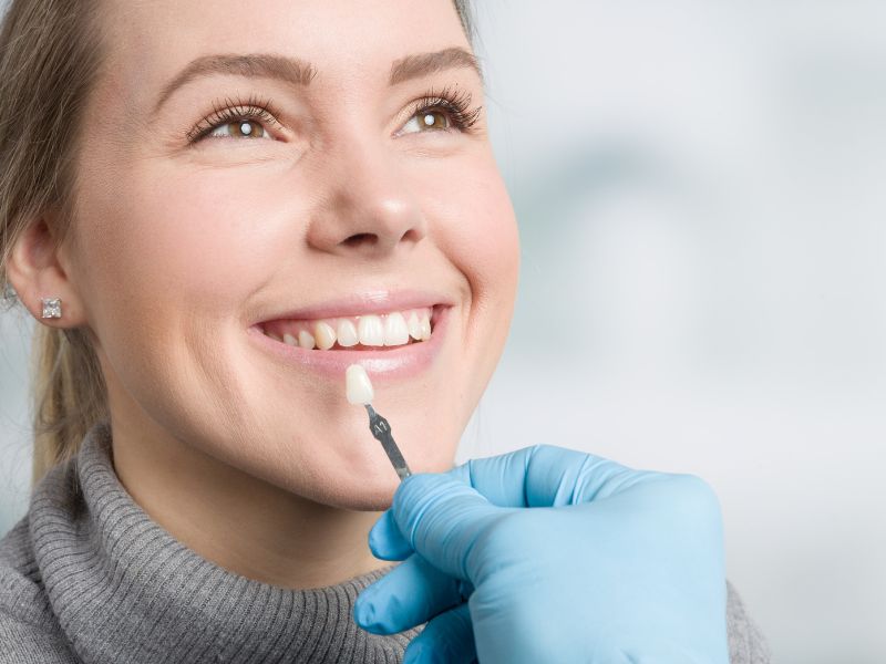 Porcelain Veneers Porcelain Veneers