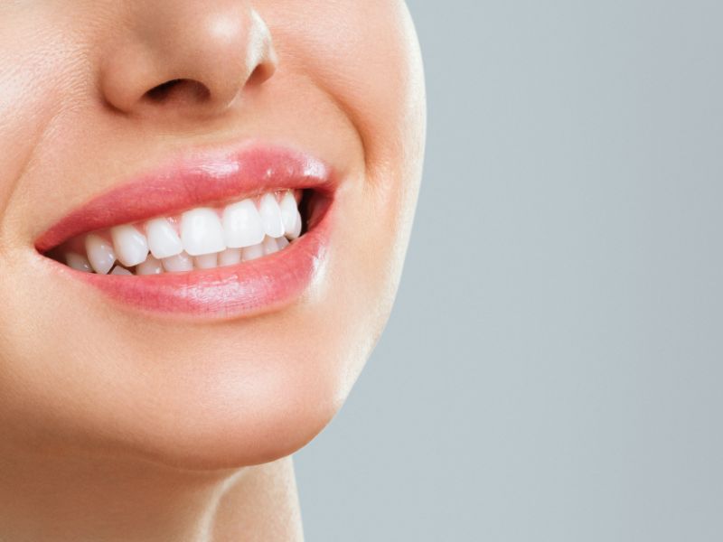 Teeth Whitening Teeth Whitening