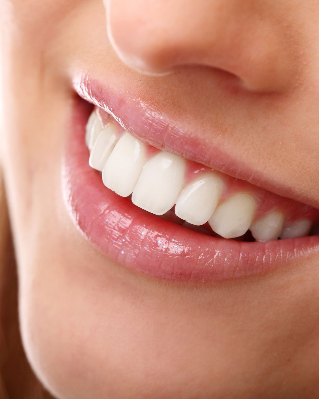 Teeth Whitening